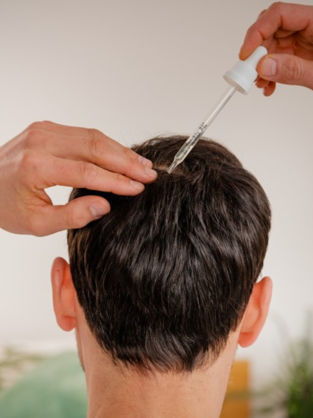 hair loss treatment (4)